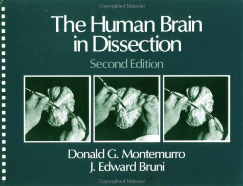 The Human Brain in Dissection
