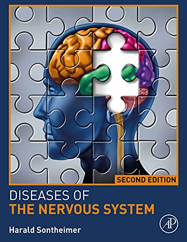 Diseases Of The Nervous System #TOP11