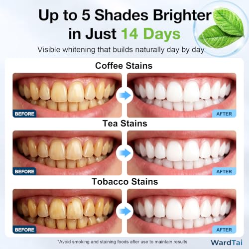 Image of Teeth Whitening Strips, 7-Day Starter Pack, 14 Strips / 7 Treatments, 6% Hydrogen Peroxide Formula with Hydroxyapatite, Mild Mint Flavor, 30-Min Routine
