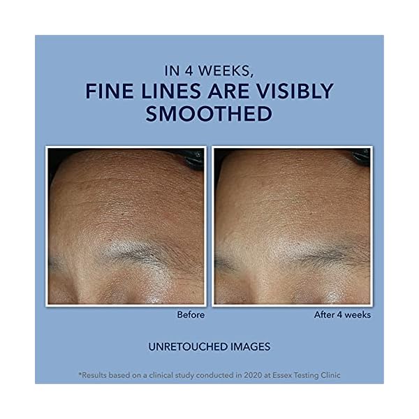 RoC Retinol Correxion Max Daily Hydration Anti-Aging Face Moisturizer with Hyaluronic Acid for Fine Lines, Dark Spots, Post-Acne Scars, Oil Free, Stocking Stuffers, 1.7 Ounces (Packaging May Vary)