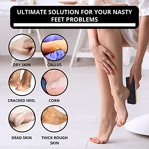 Love Natural Pumice Stone For Feet - Ultimate 2-In-1 Scrubber And Professional Exfoliating Rock For Feet Hands Body Care - Pumice Stone For Dead Skin & Callus Removal (Black) #TOP3