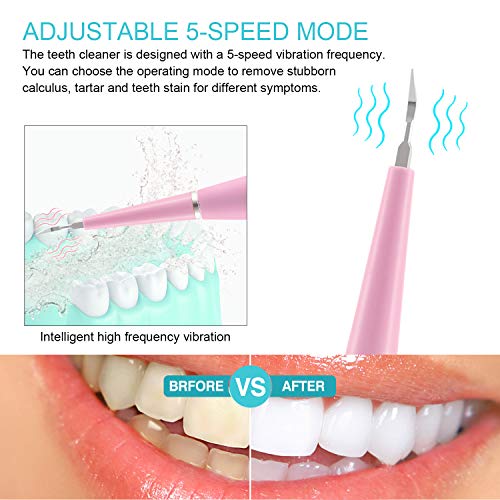 image for MIGVELA Electric Dental Calculus Remover Tool Kit with 5 Adjustable Mo