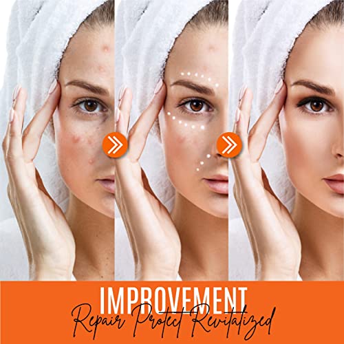 30% Vitamin C Serum (2 Fl Oz) Pure Organic Anti- Wrinkle + Hyaluronic Acid + Retinol + Vitamin E + Vitamin B, Facial Serum For Anti-Aging, Wrinkles, And Fine Lines. #TOP5