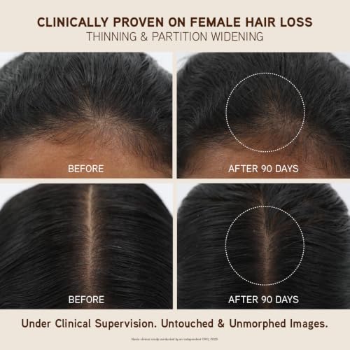Indulekha Ayurvedic Hair Growth Oil 250ml - Image 4