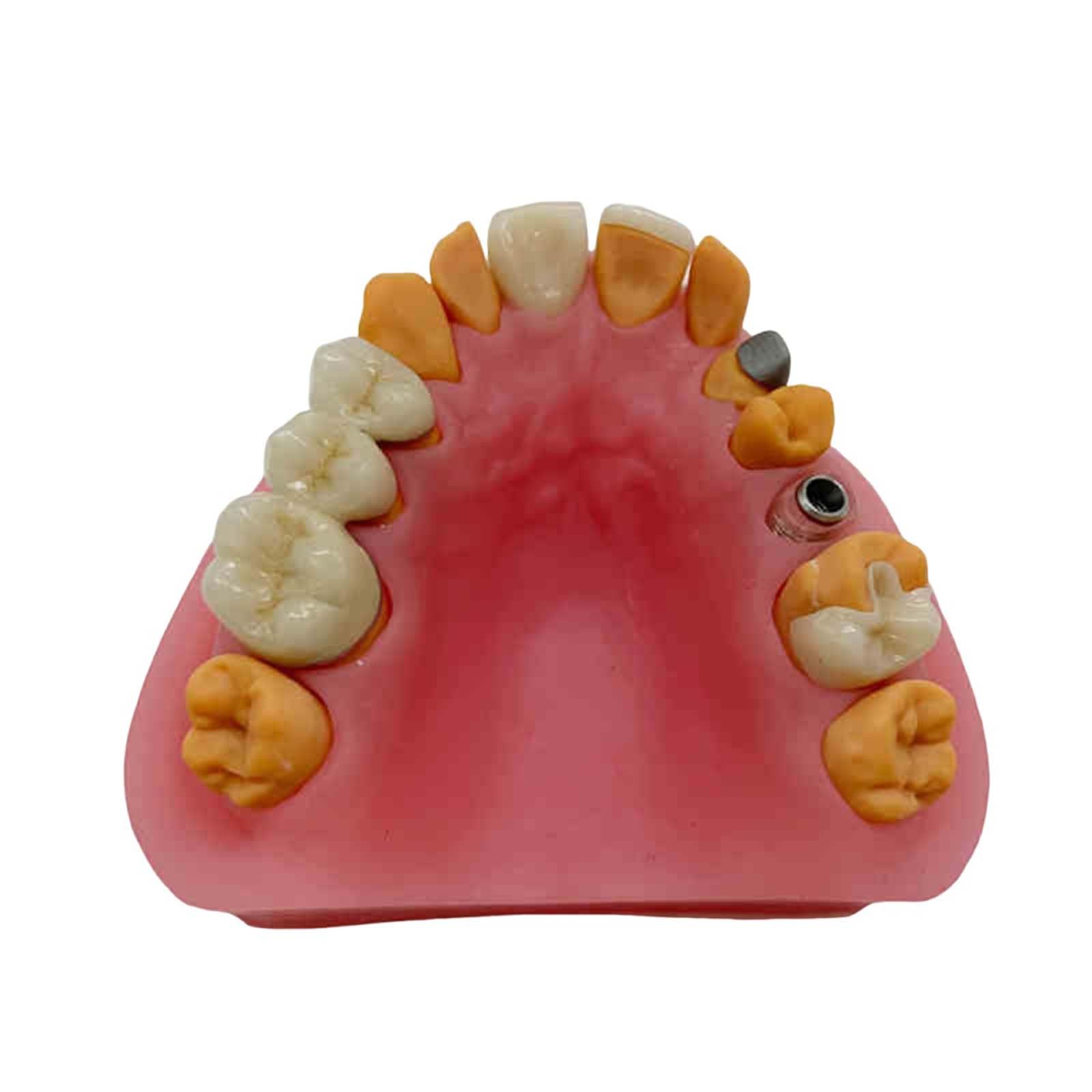 Modello espositivo per Protesi Dentarie, manichino Dentale, Modello didattico per odontoiatria Orale, stampi per odontoiatria Orale