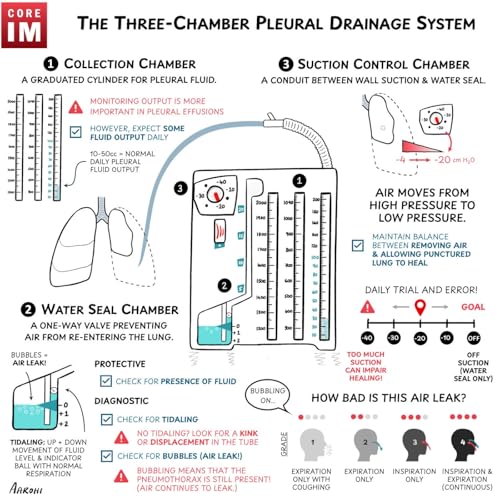 #186 Pneumothorax: 5 Pearls Segment