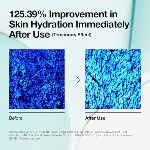 Image of Anua PDRN 100 Hyaluronic Acid, Hydrating Dual-Textured Toner Pads, Salmon DNA & Collagen Face for Glass Skin Glow & Makeup Prep, Sensitive & Dry Skin, Korean Skincare, 6.1 fl oz, 60 Count