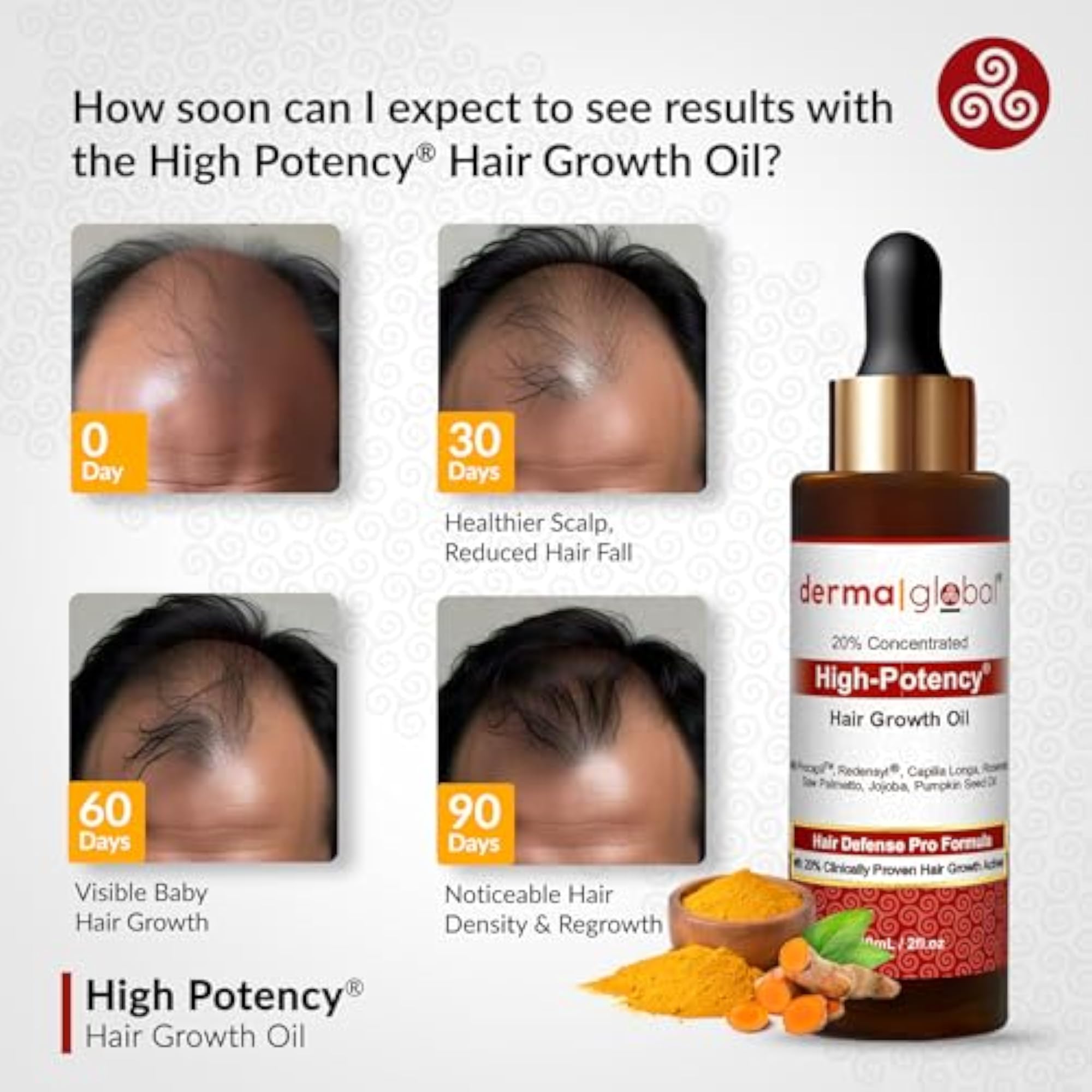 High Potency Hair Growth Oil for Men & Women, 200ml