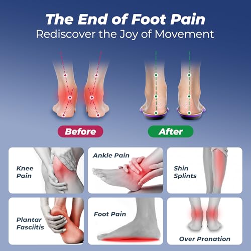 Image of Professional Heavy Duty Support Pain Relief Orthotics - Over 230+ lbs Plantar Fasciitis High Arch Support Insoles for Women and Men, Flat Feet Orthotic Insert, Work Boot Shoe Insole