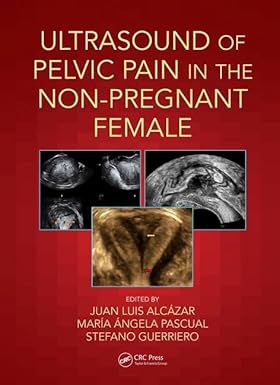 ULTRASOUND OF PELVIC PAIN IN THE NON PREGNANT PATIENT (PB 2019)