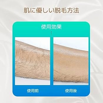 Amazon | 【2025業界新傑作】脱毛器 無痛脱毛器 こするだけ 除毛