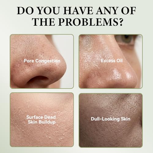 XILRVON XERVON Rice Mochi Face Cleanser, All in One for Face Wash & Mask, Deep Pore Cleansing Moisturizing, Blackhead Remover, Sebum Control, with Rice Water, Green Tea & Walnut Shell Powder, 4.23 OZ