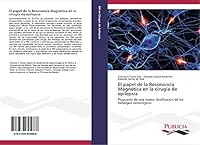 El Papel de La Resonancia Magnetica En La Cirugia de Epilepsia 3639645669 Book Cover