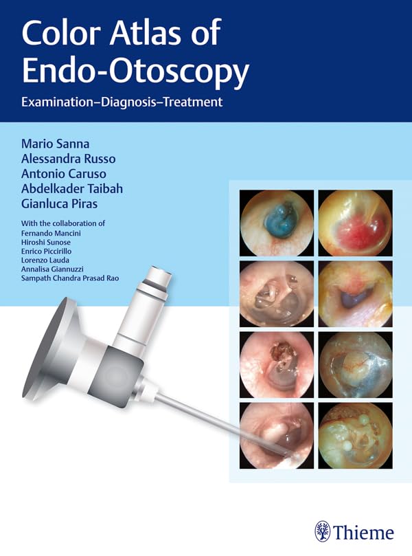 Color Atlas of Endo-Otoscopy: Examination - Diagnosis - Treatment (English Edition)