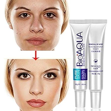 bioaqua acne rejuvenation cream bpom