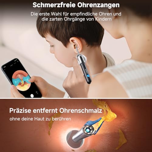 BEBIRD R1 Ultra Ohrenschmalz Entferner Kamera, Ohrenreiniger mit Otoskop für Zuhause, Komplett-Set mit Sichtbarer Dropper & Pinzette, Für Ohr & Nase & Rachen Untersuchung der Familie-Schwarze