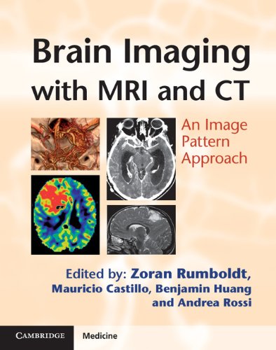 Brain Imaging with MRI and CT: An Image Pattern Approach (Cambridge Medicine (Hardcover)) (English Edition)