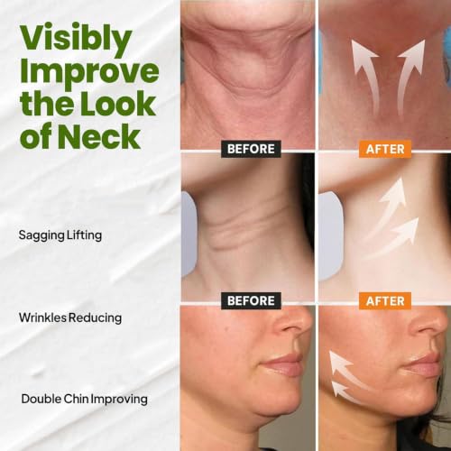 Crema para el cuello antiarrugas con colágeno tensor y rodillo de masaje 2