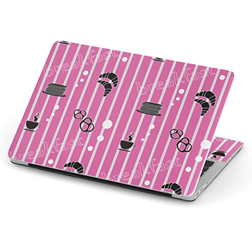 igsticker Macbook Pro 13inch 2020/19/18/17/16 ��p�X�L���V�[�� A1989 / A1706 / A1708 �}�b�N�u�b�N �v�� 13�C���` ��p�V�[�� �t�B���� �X�e�b�J�[ �A�N�Z�T���[ �ی� 006404 ��