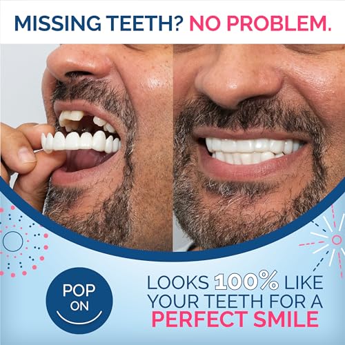 Pop On Veneers UL-AZ0001 Custom-Made Pop On Veneers | Comfort Fit Clip On Veneers | At-Home Impression Kit | Stain-Resistant | Veneers Teeth For Women, Fake Teeth Veneers thumb #1