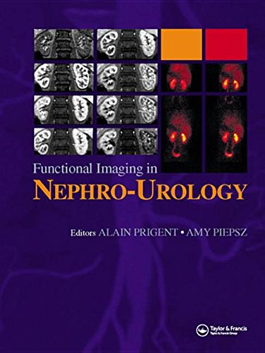 Buy Functional Imaging in Nephro-Urology — BookShops.in