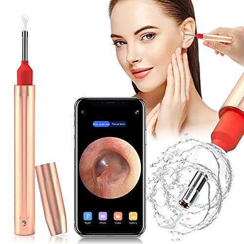 Ear Wax Removal, Carocallo Ear Camera 1080P FHD Wireless Ear Wax Removal Tool Otoscope Ear Cleaner Endoscope with 6 LED Lights Ear Wax Remover for iPhone, iPad, Tablet and Android Phones