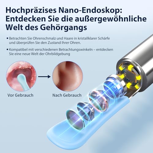 Ohrenschmalz Entferner Otoskop, Robofun Ohrenreiniger Mit Kamera, 1000W HD WiFi 360°-Weitwinkel Ohrreiniger mit 6 LEDs für iPhone, iPad und Android-Smartphones, für Baby Kinder Erwachsene (Schwarz)