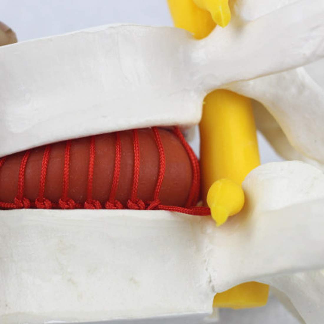 Modèle d'éducation Médical Spine Lumbaire Modèle Hine Disc Ceinture Distrevoir Modèle Etude de modèle