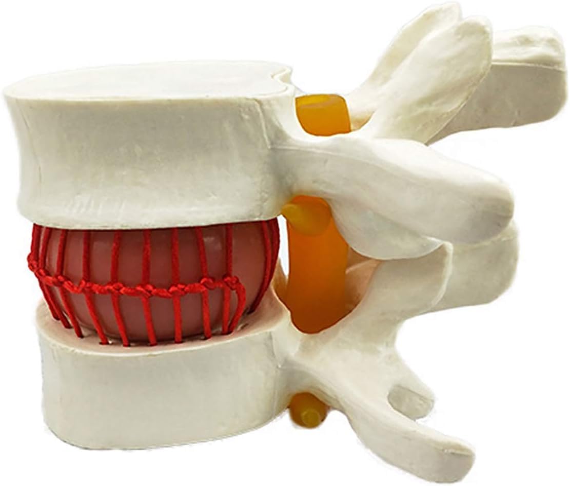 Modello di Dimostrazione del Disco Lombare Umano Modello della Colonna Sonora del Dorso Giallo Umano Colonna Lombare Anatomica Colonna Vertebrale Lombare