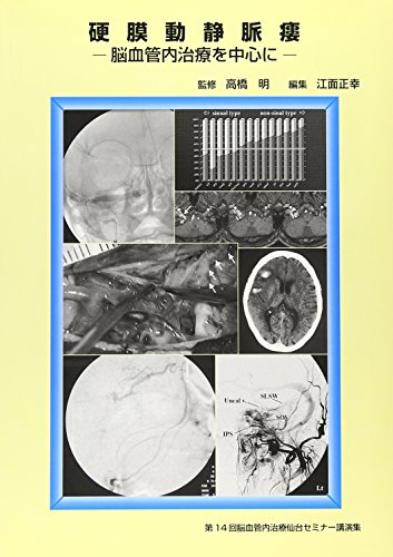 硬膜動静脈瘻―脳血管内治療を中心に第14回脳血管内治療仙台セミナ