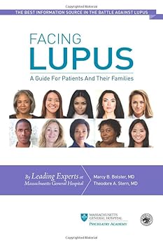Paperback Facing Lupus: A Guide for Patients and Their Families Book