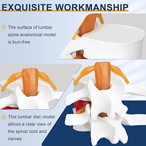 Image of Healthible Human Lumbar Disc Herniation Demonstration Model - Anatomical Lumbar Vertebral Model Disc Herniation Modelfor Education and Study