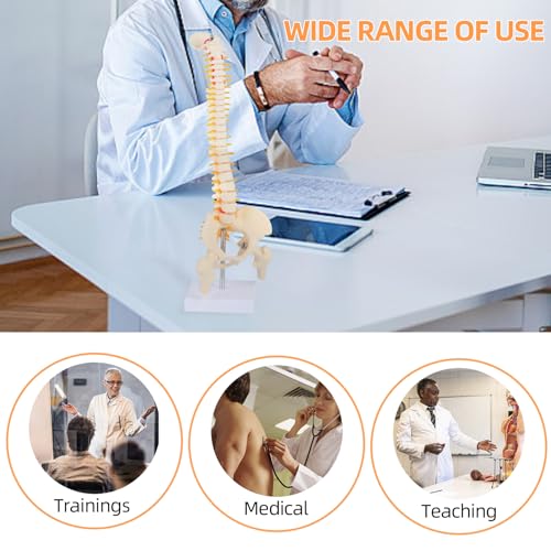 Image of 1 /2 Life Size Spine Anatomy Model - 17.7 inch Human Spine Model with Spinal Nerves, Pelvis, and Femur, Includes Stand and Pointer for Teaching Use.