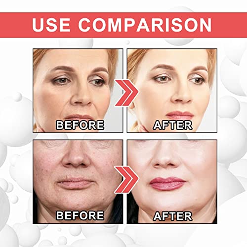 2Pcs Collagen Boost Anti Aging Serum, Collagen Boost Anti Aging Serum For Face Wrinkles, Skincare Glow And Protect Serum For All Skin Type #TOP3
