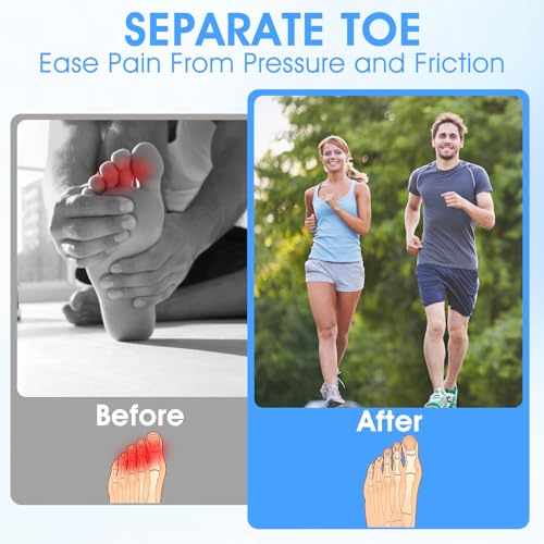 Image of Silicone Toe Sleeves, 24 Pcs Pinky Toe Protectors Women Toes Cushions for Small Hammer Toes and Fingers Blisters Calluses Pain Relief Reduce Rubbing