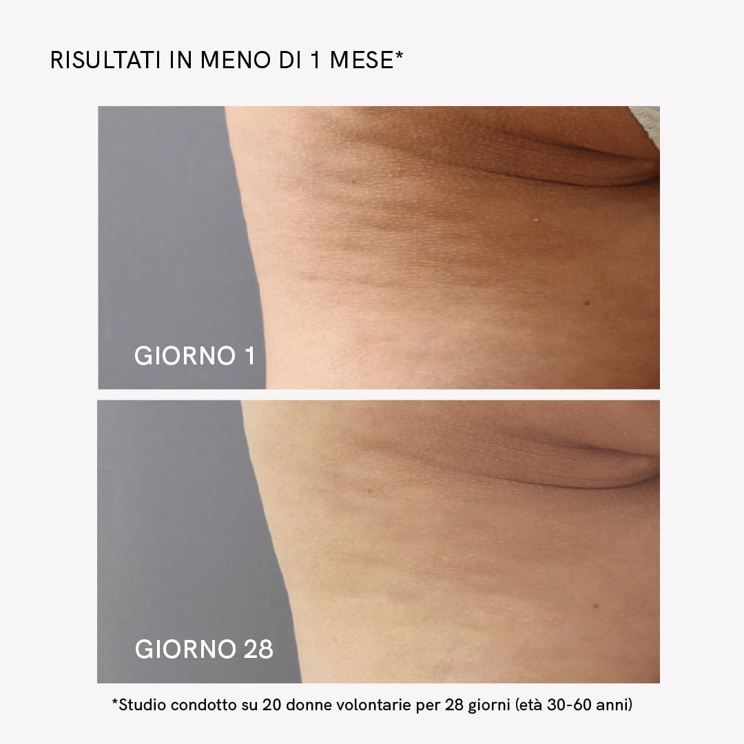 MASDERM - Crema Anticellulite Riducente 500 ml, Crema Rassodante Corpo, Gel Riducente Addome e Glutei per Radiofrequenza Corporea, Trattamento Anticellulite Professionale, Pelle Soda e Tonica