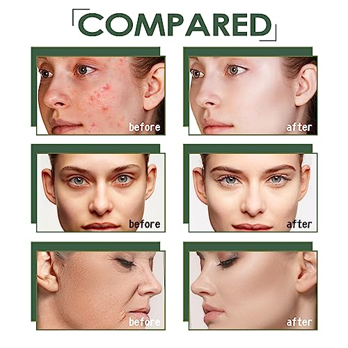 Whitening Rejuvenating Essence,Licorice Extract Whitening Essence,Women Face Firming Tightening Serum,Licorice Extract Wrinkle Removal Essence,Moisturizing Fast Absorbing,Brightness Bloom Young Skin - Image 4