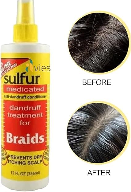 Sulfur Medicated Anti-Dandruff Conditioner for Braids 356 ml, White, 356 ml (Pack of 1) - Image 2
