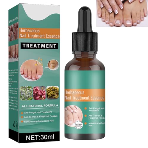 Soluzione per la Cura Delle Unghie,Fungo Unghie Piedi,Trattamento Unghie,Cura delle Unghie,Soluzione per La Riparazione delle Unghie del Piede,Liquido per Infezione delle Unghie 30ml