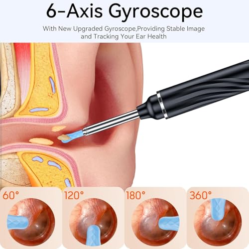 Image of Ear Wax Cleaner with Camera,1080P Ear Cleaning Tool Kit, Wireless EarScope for Adults and Kids, Ear wax Removal Tool with light (Black)