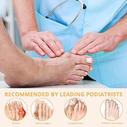 Pedigoo Bunion Corrector For Women And Men, Slip Proofing Version Bunion Toe Separator, Orthopedic Bunion Splint For Big Toe Pain Relief And Toe Straightening Beige #TOP3