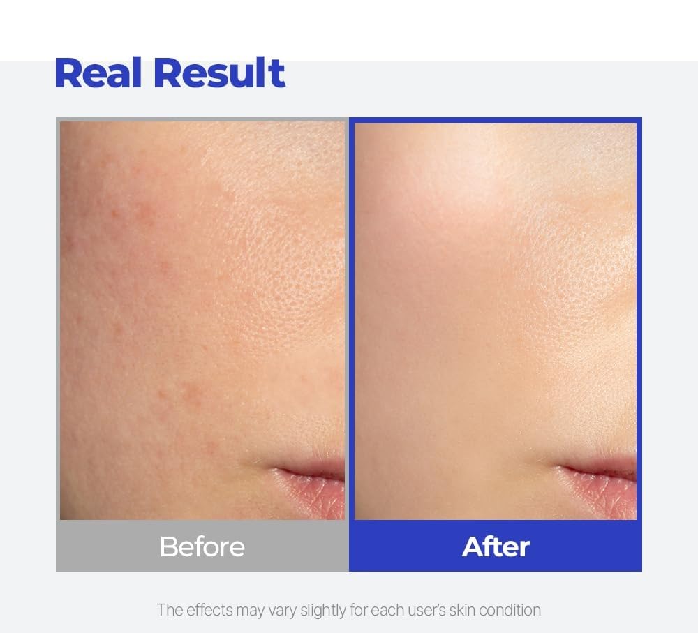 Hyaluronic Acid Watery Sun Gel SPF 50+ PA++++, Lightweight moisturizing Sunscreen with No White Cast,non-sticky UV Protection, 50ml - 2 Pack - Korean Sunscreen - Image 5