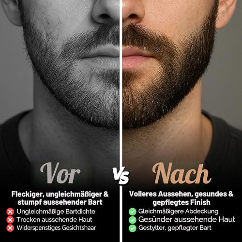 Red-Blooded Bartwachstumsset – Bartroller + Bartöl + Bartbalsam – stimulieren Sie Bart und Haarwachstum Duft-Bartpflege-Geschenk für Männer – 0,5 mm Dermaroller für Haare, Bart Nachwachsen