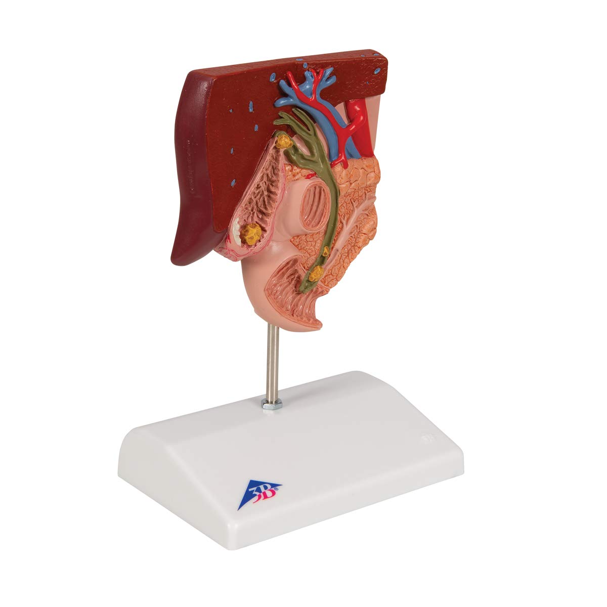 Close-up view of the 3B Scientific K26 Gallstone Model