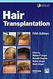 Hair Transplantation