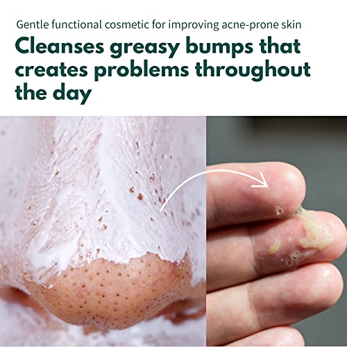 Pcalm Clear Deep Pore Gentle Vegan Foam Cleanser Aha Bha 5 Oz Non-Stripping Drying- Calming Oily Dry Sensitive Acne-Prone Skin Plant-Based No Chemicals Sebum Control Blackhead Remover Pore Tightening #TOP2