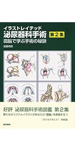 Amazon.co.jp: イラストレイテッド泌尿器科手術―図脳で覚える術式と