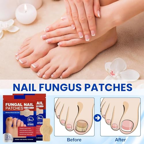 Image of Fungal Nail Repair Patches for Toenail & Fingernail Care - Hydrogel Nail Treatment Patches for Brittle, Thick and Discolored Nails | Overnight Adhesive Nail Care Strips, 10 Patches