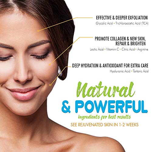 Ebanel 30 AHA Chemical Peel, Gel Form, Face Peeling Treatment with