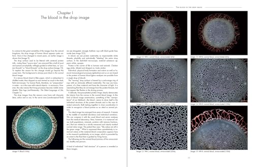 Corona Blood Phenomena: Microscopic Examinations of Blood, Serum, and Cerebrospinal Fluid: Healthy -